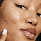e.l.f. SKIN Blemish Breakthrough Stick It To Zits, 36 Clear Hydrocolloid Pimple Patches, 36 ct