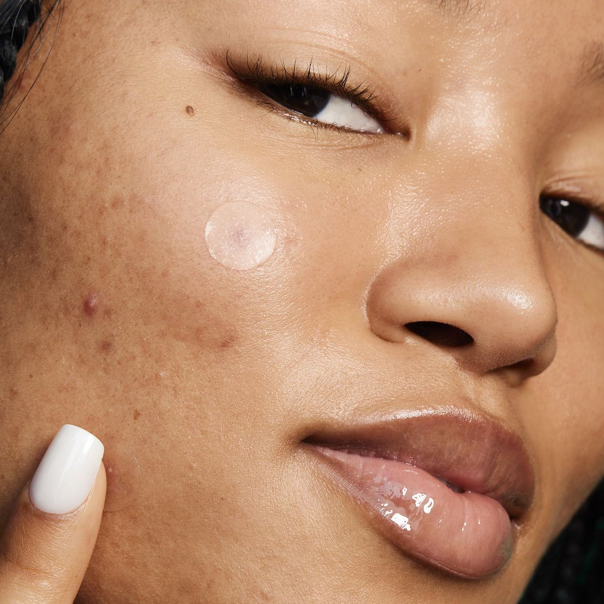 e.l.f. SKIN Blemish Breakthrough Stick It To Zits, 36 Clear Hydrocolloid Pimple Patches, 36 ct