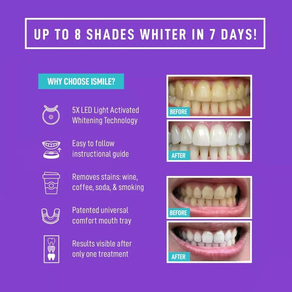 I Smile Professional Whitening Gel Portable Teeth Whitening Kit